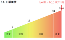 Load image into Gallery viewer, Home Sleep Test Service (available in Hong Kong only)