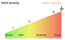 Load image into Gallery viewer, Home Sleep Test Service (available in Hong Kong only)