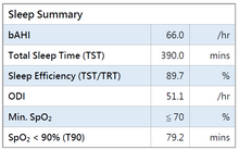 Load image into Gallery viewer, Home Sleep Test Service (available in Hong Kong only)