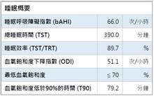 Load image into Gallery viewer, Home Sleep Test Service (available in Hong Kong only)